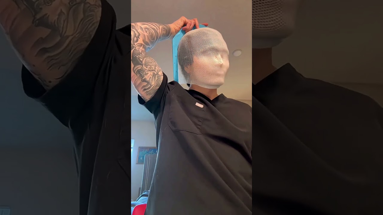 😱WHY RADIATION THERAPY MASK IS USED? 