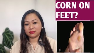 All about corns😨😨 and its different types ...Causes and its  treatment with homoeopathy🍀