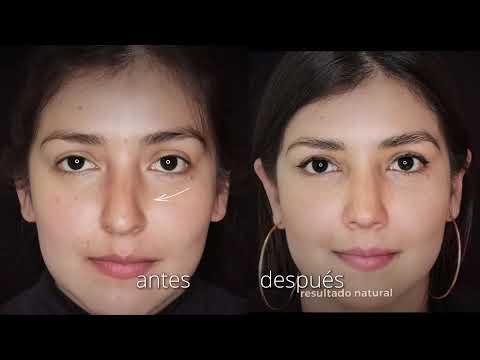 Video: 3 formas de arreglar una nariz torcida