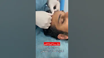 مساج الصداع مركز بسمة الحياة الطبي 
