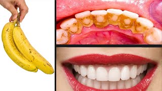 Diş Hekimlerinin bilmenizi istemediği sır: Sadece 2 dakikada Diş Beyazlatma