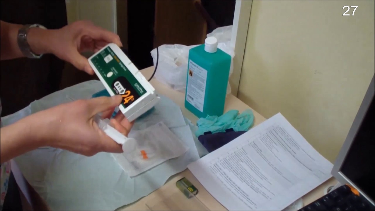 Subcutaneous automatic syringe perfusion (ro - en)