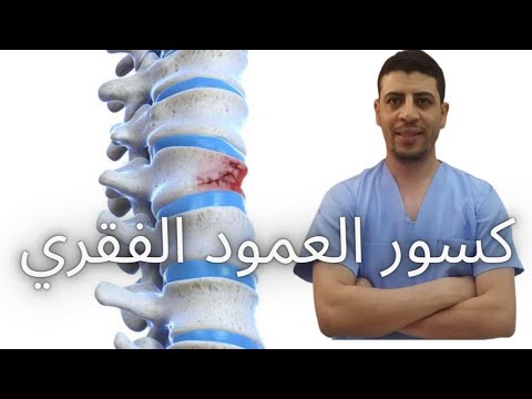 كسور العمود الفقري الكسر الانضغاطي للفقرات تثبيت الفقرات حقن الفقرات دكتور احمد حسن جمعه