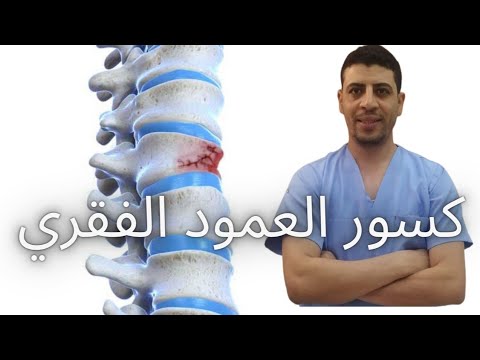 فيديو: 4 طرق لعلاج كسور الانضغاط بجراحة الظهر