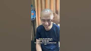 Cùng soi kết quả xăm chân tóc sau 1 năm tại VNSCALP1-Year Scalp Micropigmentation Result at VNSCALP