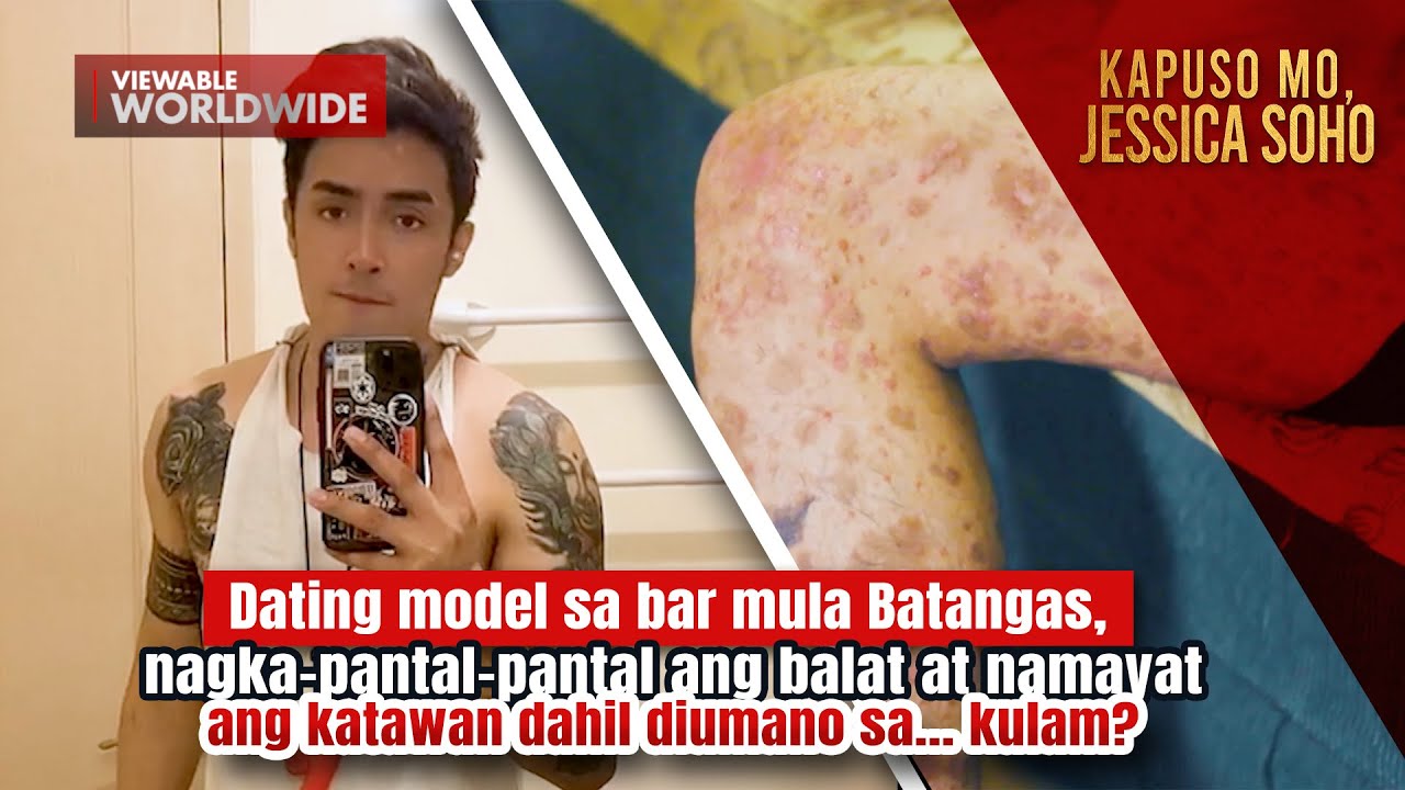 Dating model sa bar, nagkapantal-pantal ang katawan dahil umano sa kulam?! | Kapuso Mo, Jessica Soho