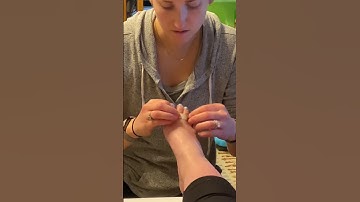 Toe buddy-taping