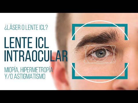Lentes Intraoculares ICL
