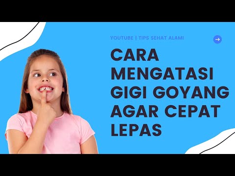 DIJAMIN!! Cara Mengatasi Gigi Goyang Supaya Agar Cepat Lepas Copot untuk Dewasa dan Anak Anak