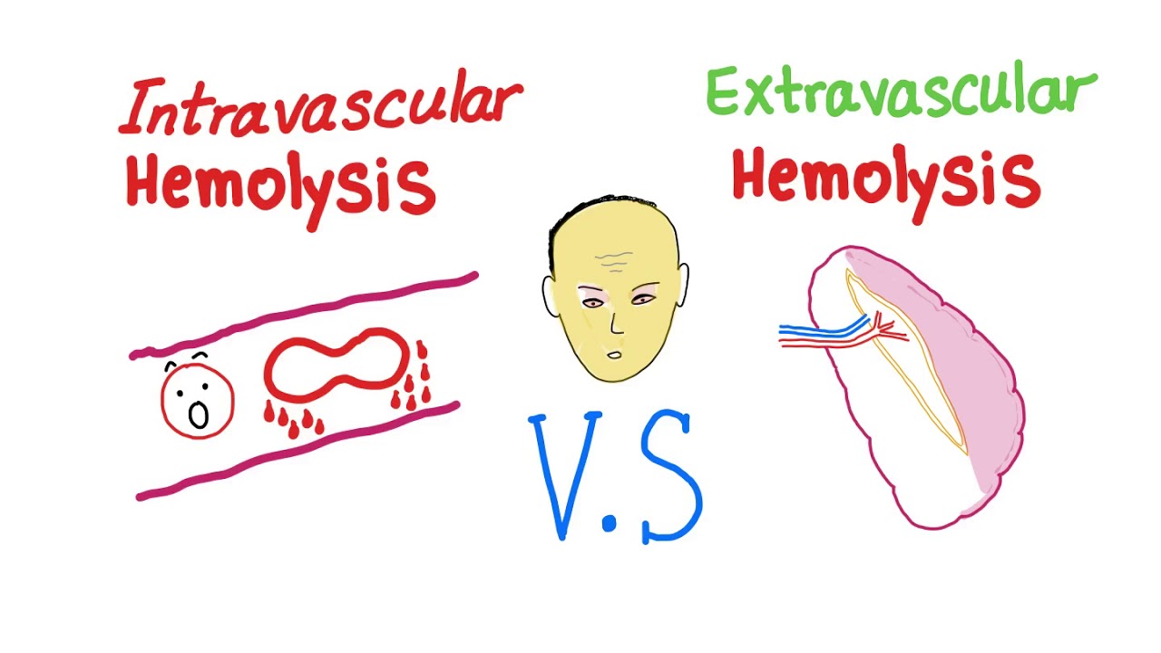 What does it mean to be intravascularly dry but extravascularly