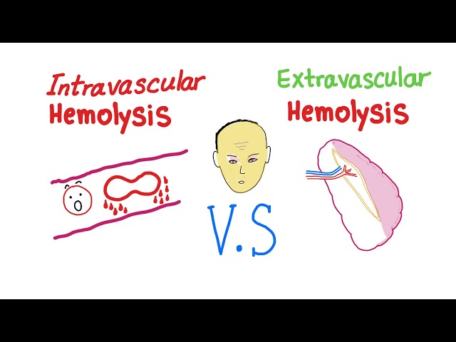 What does it mean to be intravascularly dry but extravascularly