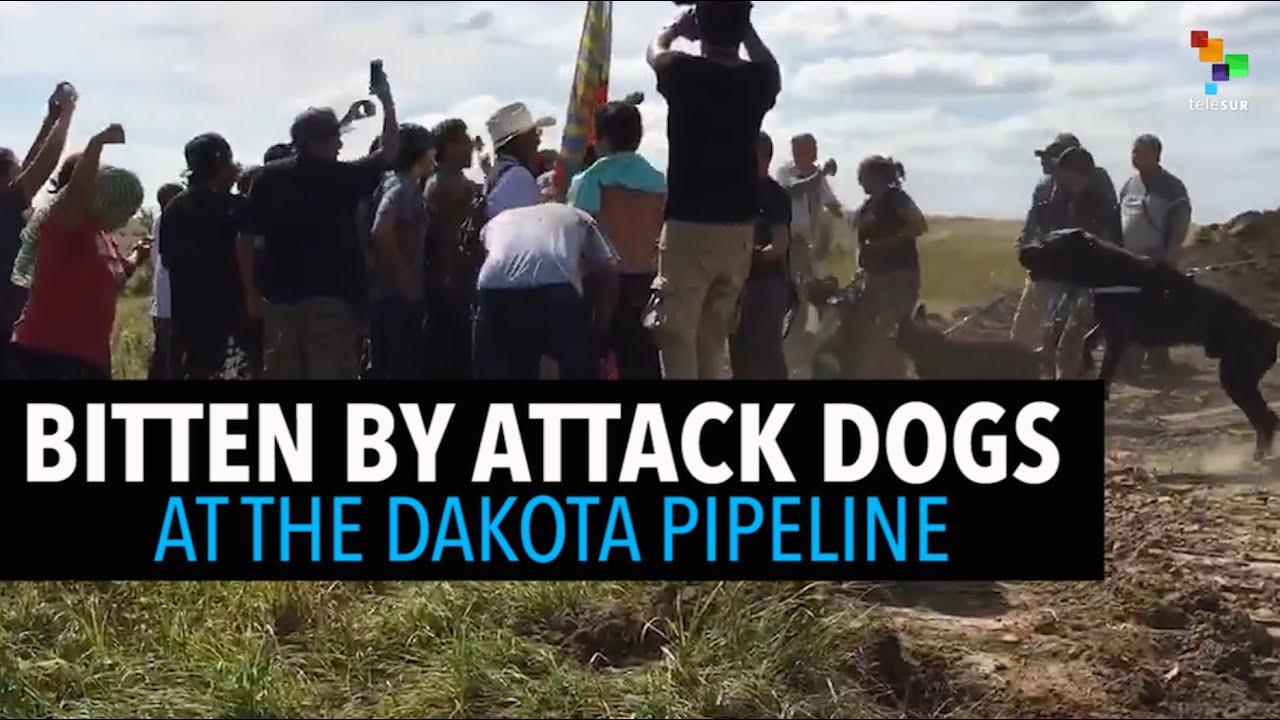 Bitten by Attack Dogs at the Dakota Pipeline YouTube
