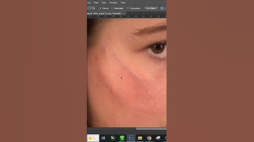 Remove Scars quickly with Patch tool #shorts #photoshoptutorial #pimplescars #tutorial