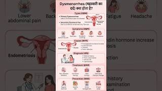 👉👉Painfull period🩸 Dysmenorrhia क्या होता है?#types#causes#diagnosis #treatment #@Medsiksha