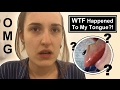 WTF Happened to my Tongue?! | TheTarative