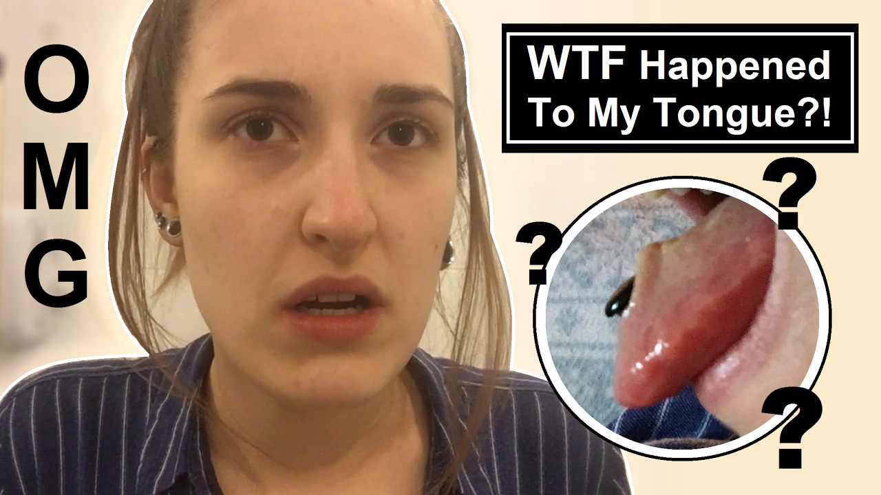 WTF Happened to my Tongue?! | TheTarative - YouTube