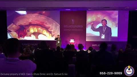 5 Top Secrets in Vertical & Horizontal Ridge Augmentation and Sinus Bone Grafting