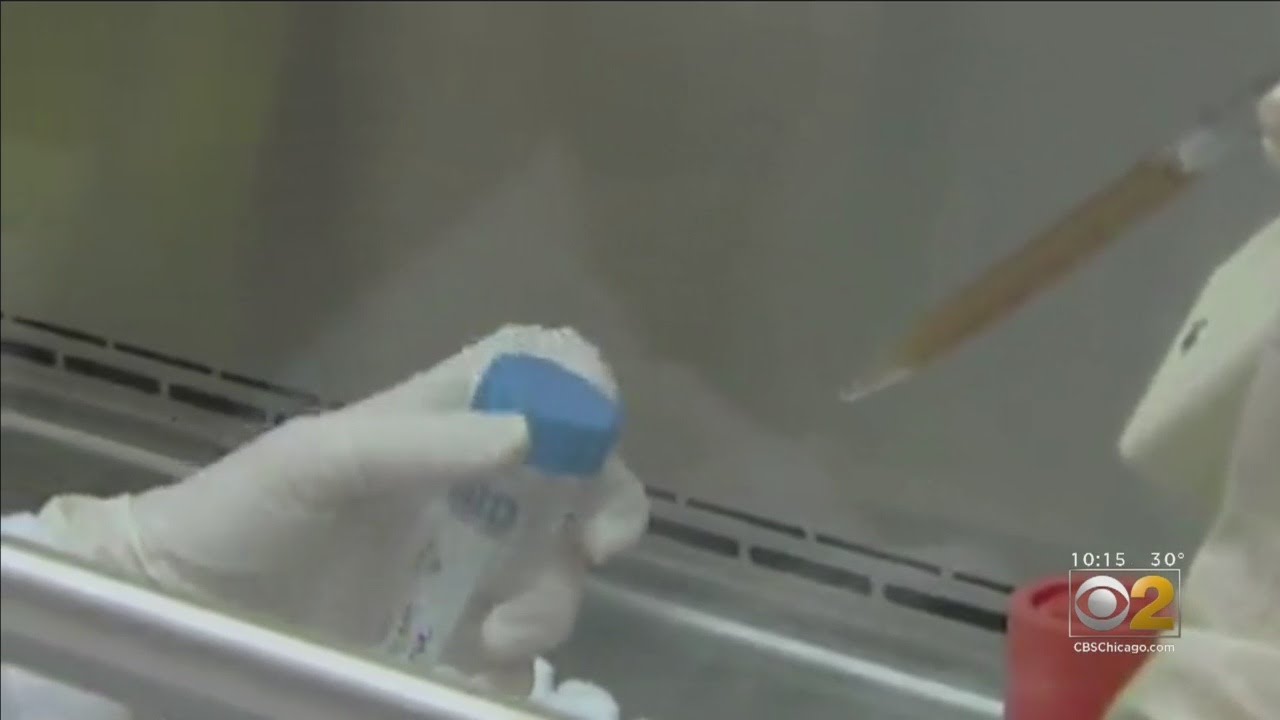 New Strain Of HIV Discovered By Abbott Labs