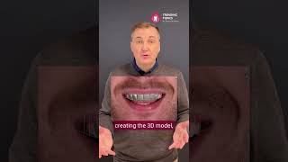 Trending Topics - Smile Design process #3shape #digitaldentist