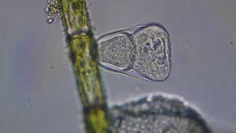 Vaginicola Builds a Home - Part 1