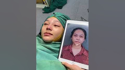 COMBO NÂNG MŨI + ĐỘN CẰM ĐẸP XUẤT SẮC | Bs Hoạt | TMV Saigon Star