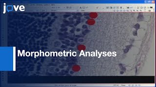 Celebrity Morphometric Analyses Of Retinal Sections l Protocol Preview Net Worth