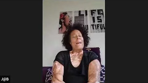 Jean was set on fire by ex boyfriend.