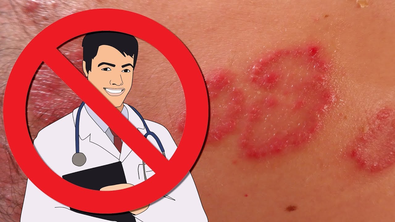 Do Dermatologists Really Know Anything Or Even Care About Psoriasis