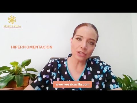 Vídeo: Hiperpigmentación Del Acné: 10 Tratamientos, Productos De Venta Libre Y Más