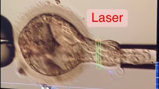 BLASTOCYST BIOPSY FOR GENETIC TESTING OF EMBRYOS