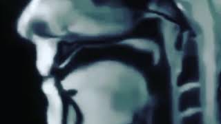 Mri Of Tongue Movement While Talking