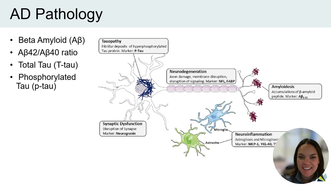 Alzheimer’s Disease Biomarker Testing and Disclosure