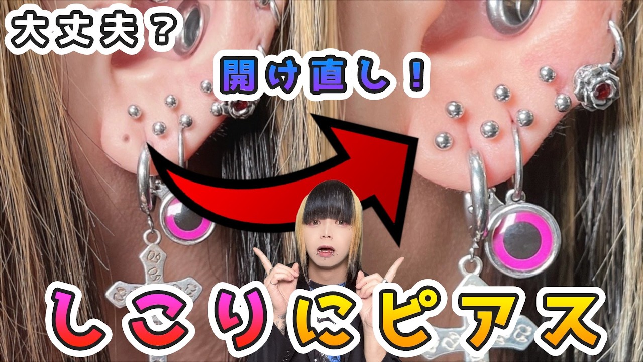 【実演】ピアスのしこりに開け直していいの？