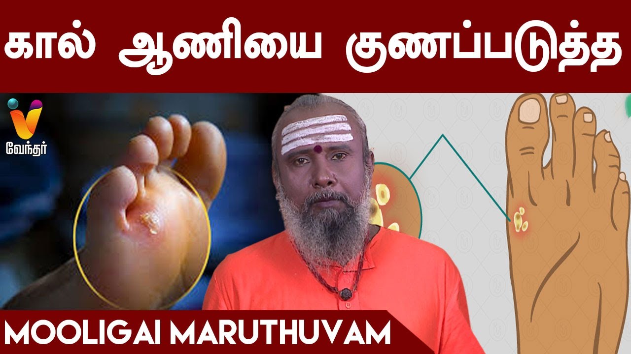 கால் ஆணியை குணப்படுத்த | Herbal remedies for foot corn | Mooligai Maruthuvam | Vendhar TV