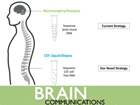 Cerebrospinal fluid liquid biopsy for detecting somatic mosaicism in ...