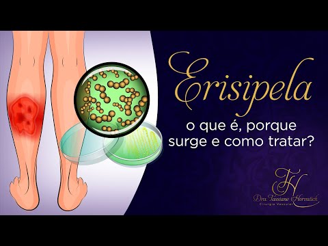 Erisipela: o que é, porque surge e como tratar?