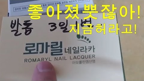 빨리허랑께! 발톱무좀, 로마릴 네일라카