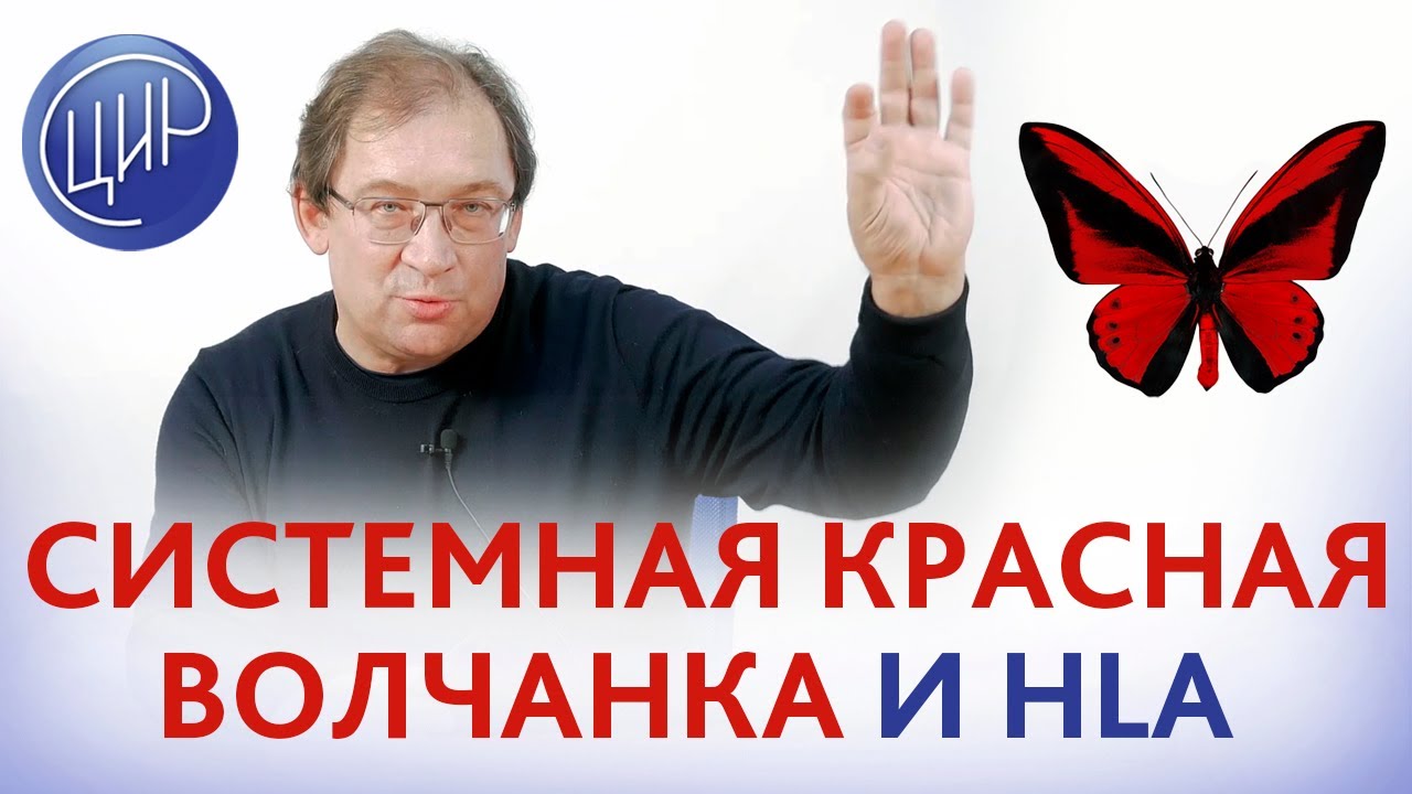 Сиситемная красная волчанка (СКВ), беременность, невынашивание и гены HLA. Гузов И.И.