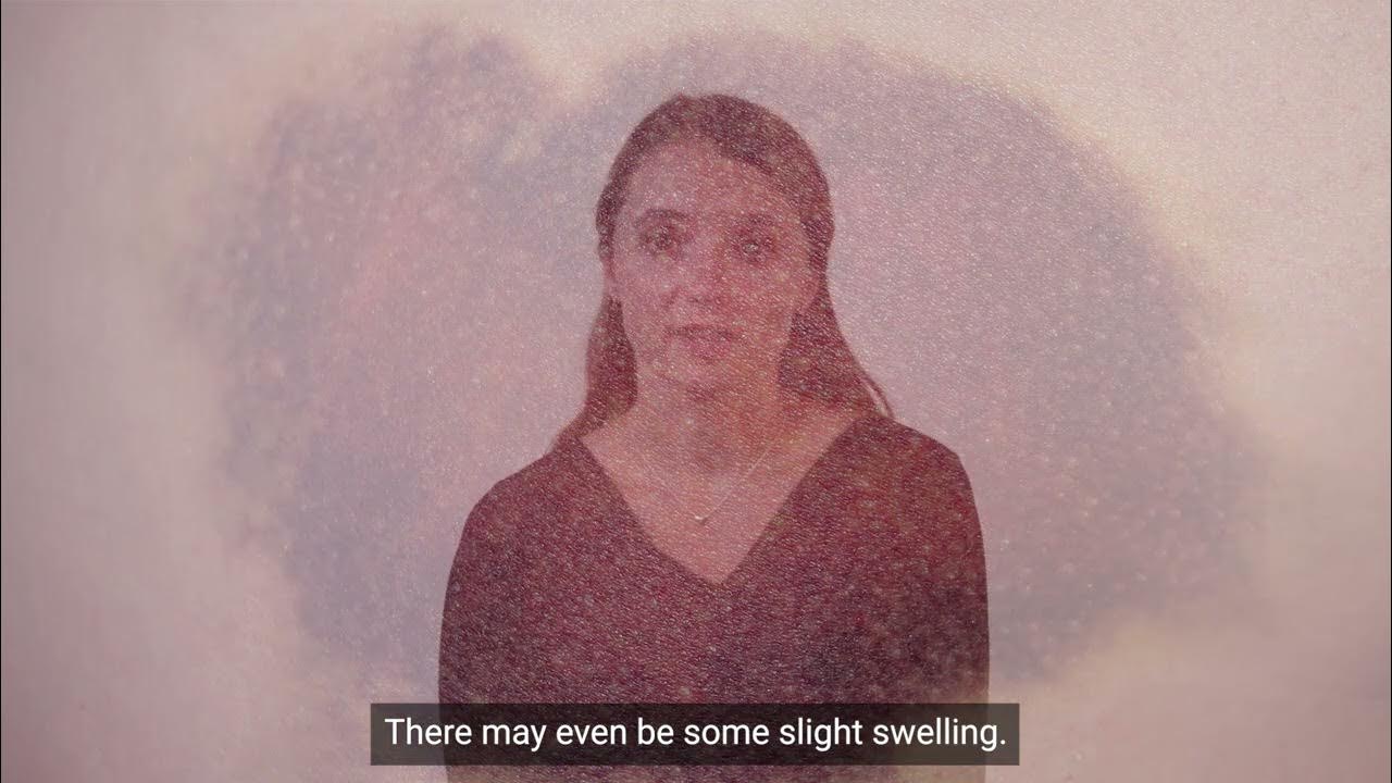 Cardiac Ablations for Abnormal Heart Rhythms What to Expect After Your