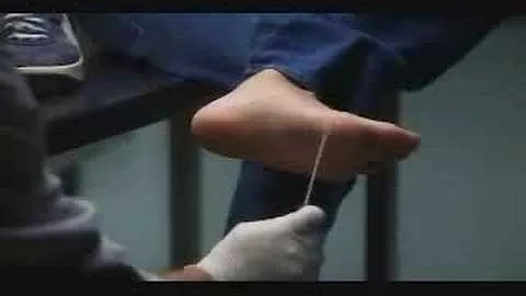 The CSI Foot Experiment