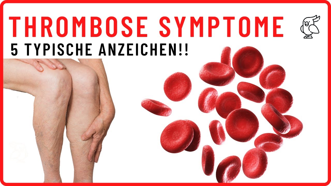 Wie Sieht Eine Analthrombose Aus THROMBOSE SCHNELL ERKENNEN Diese 5 Thrombose Anzeichen/Symptome