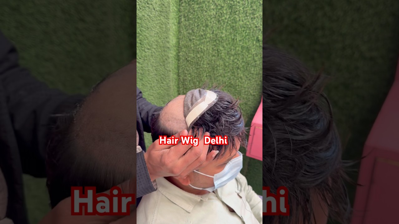 Hair Wigs In Delhi | 9990115900 | Hair Wig Price 