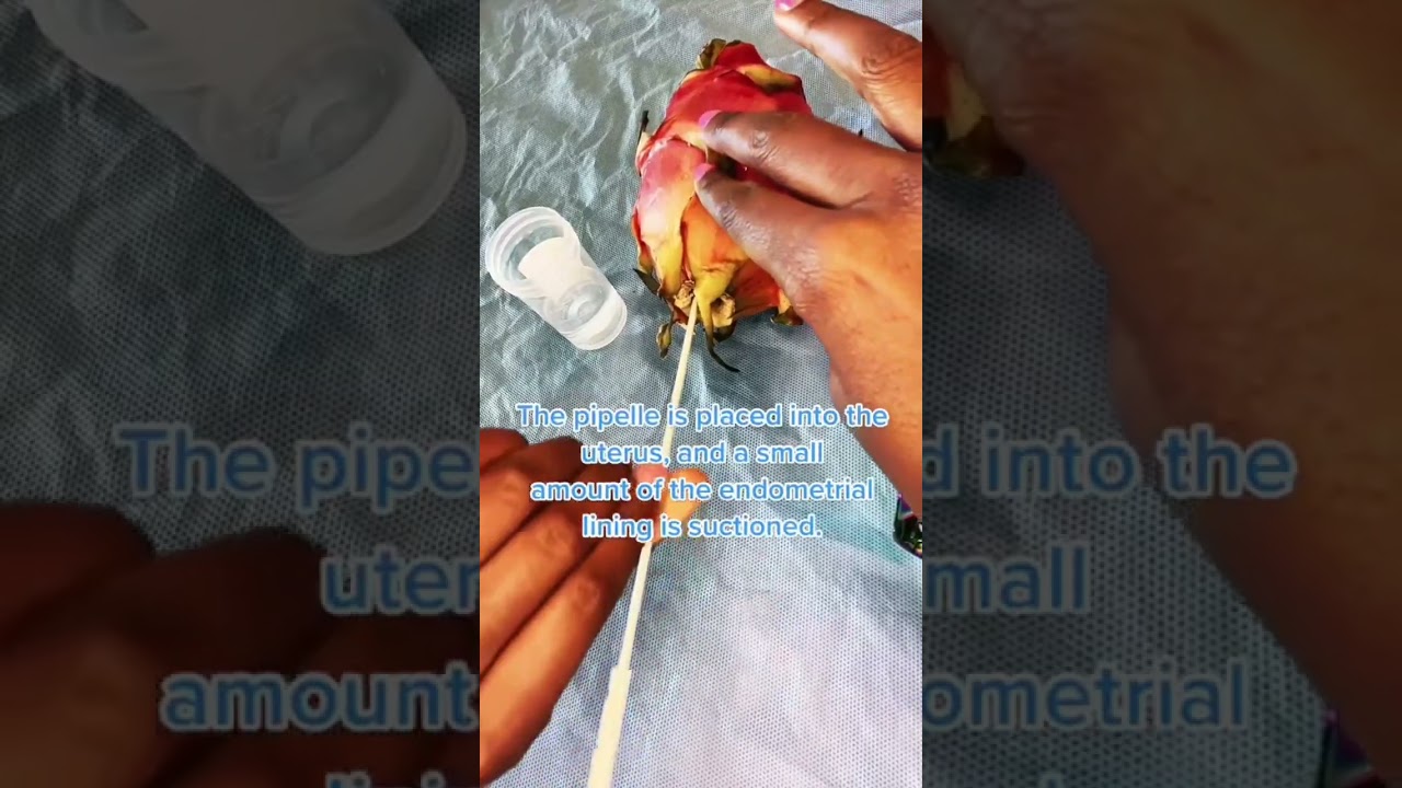 What is an Endometrial Biopsy?