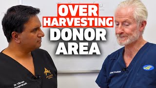 The Problem With Over Harvesting In The Donor Area | The Hair Loss Show