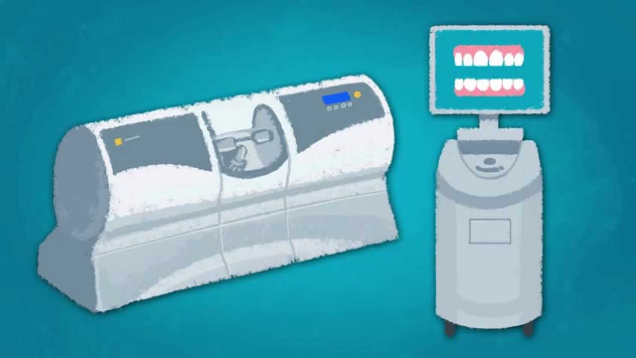 SmileGeneration | CEREC® CAD/CAM | Crowns, Inlays and Onlays long - YouTube
