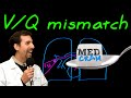 Ventilation Perfusion (VQ) Mismatch Explained Clearly