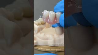 Flipper Partial and Posterior Bridge @EnvisiontecMain #envisiontec #dental #teeth #lsk121shorts