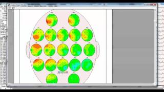 Effective Connectivity Surface (ECS)
