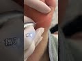 【魚の目ケア】#shorts
