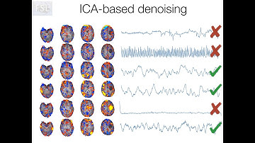 30. Resting State: Single Subject ICA (Rest E3)